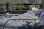 زن جیرفتی در اثر سوختگی با چراغ نفتی فوت کرد